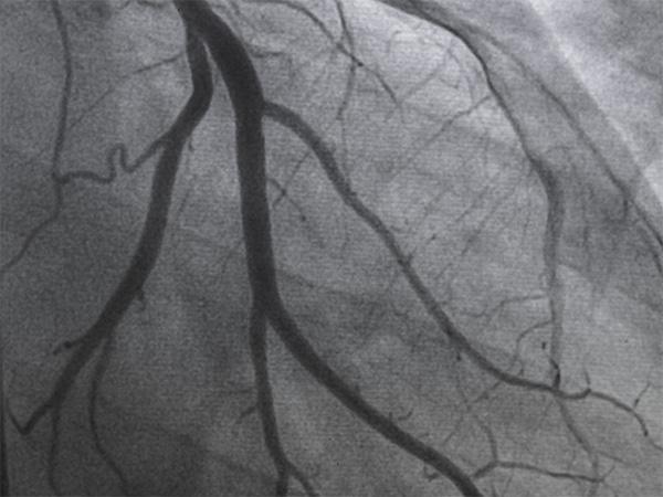 Mintz Advises Philips on SpectraWAVE Acquisition