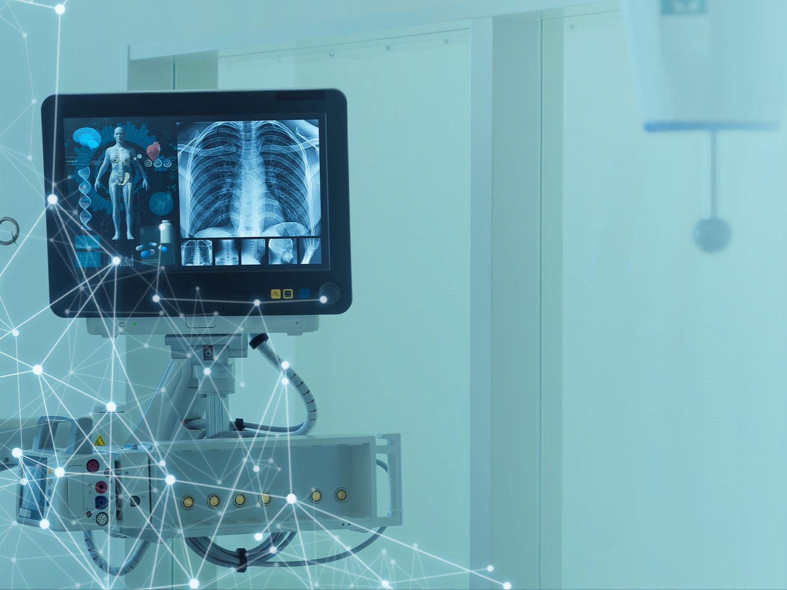 A monitor with an x-ray showing close up images of a chest
